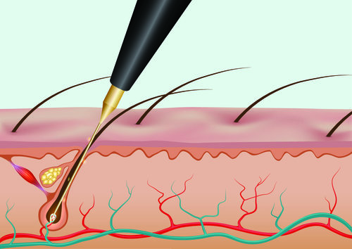 Guia para depilação facial feminina